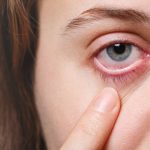 Outono pode agravar sintomas de alergias oculares em crianças.